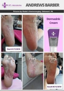 Dermazink Cream